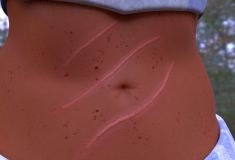 torsoscar